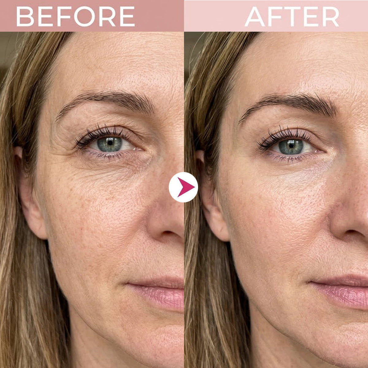 ✨ Visibly Smoother, Firmer-Looking Eyes ✨ LOVILDS P7 Eye Renewal Crème