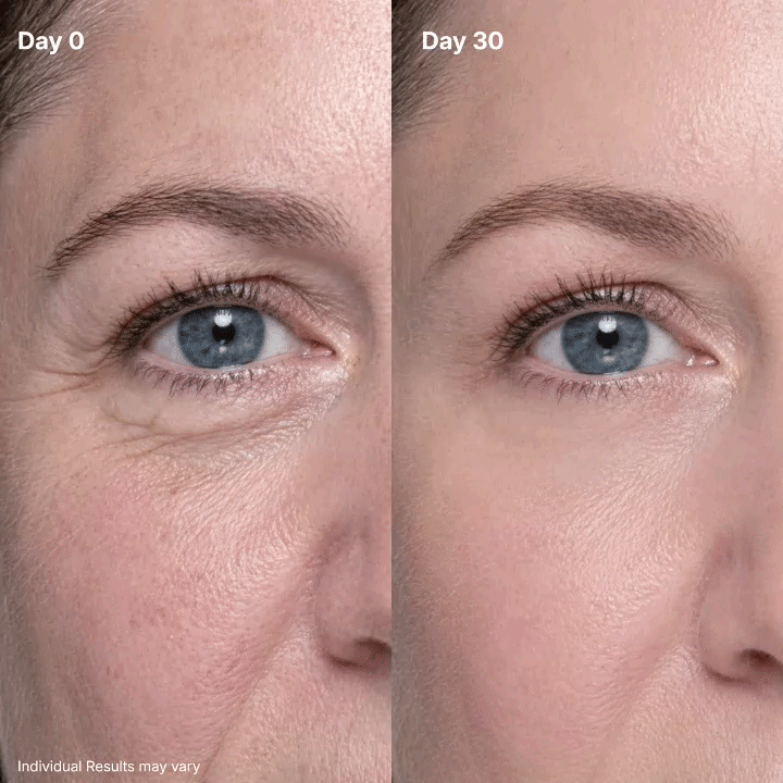 ✨ Visibly Smoother, Firmer-Looking Eyes ✨ LOVILDS P7 Eye Renewal Crème